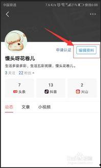 你的頭條名稱可以改嗎,揭秘如何打造引人注目的新聞標題