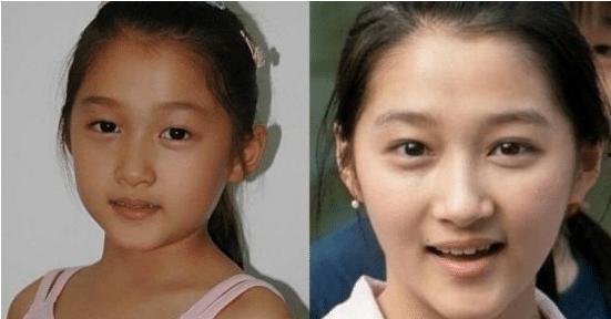 小時候長得丑的明星,盤點小時候長得丑的明星蛻變之路