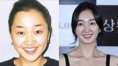 韓國(guó)明星牙齒白,韓國(guó)明星牙齒美白秘訣大揭秘